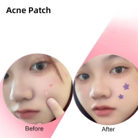 Pimple Patches